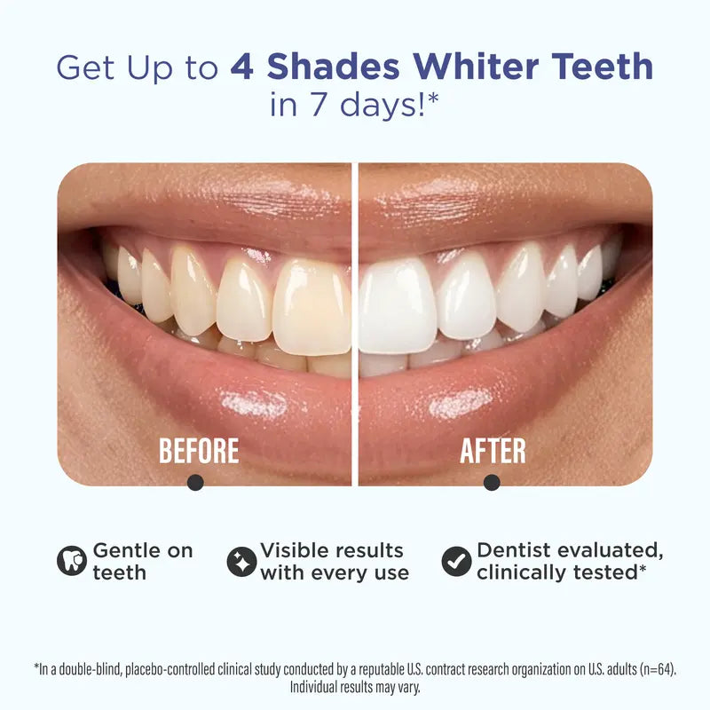 Whitening Strips, 7-day treatment (7 Packets - 2 Strips per pack) - Non-Slip, Dry Strip Technology
