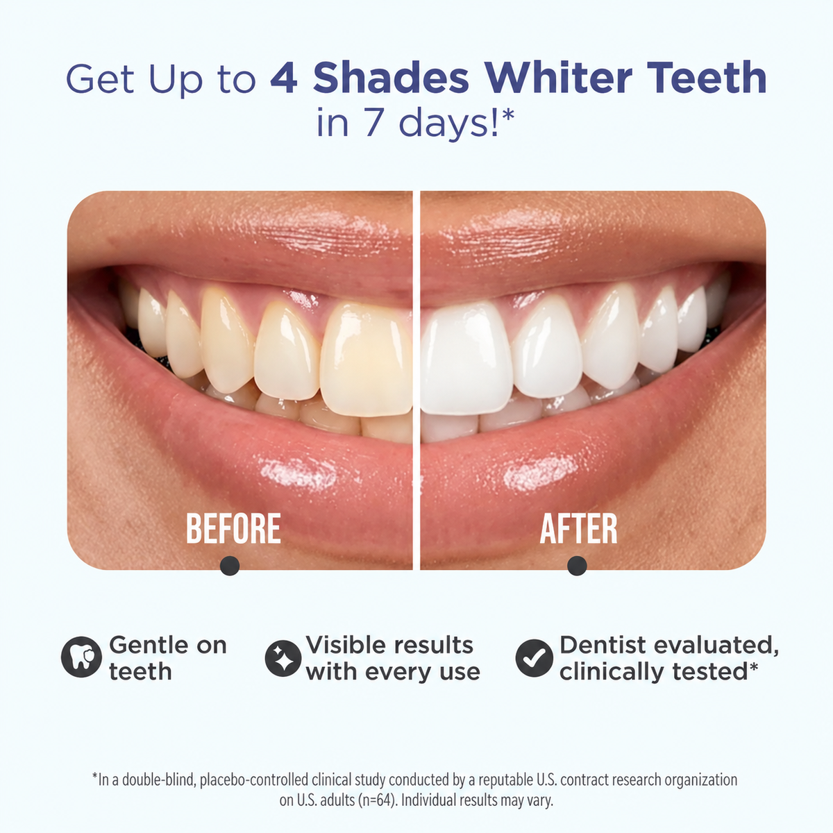 Whitening Strips, 7-day treatment (7 Packets - 2 Strips per pack) - Non-Slip, Dry Strip Technology
